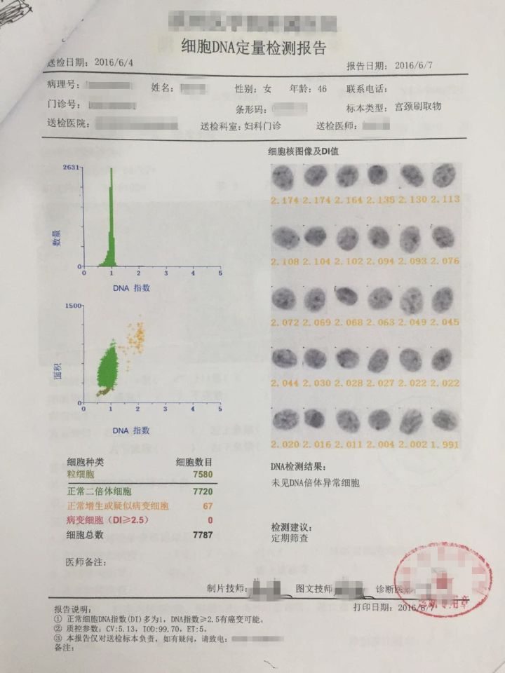 此外,癌变细胞无限增殖的特性,使dna大量堆积,通过检测细胞dna的相对