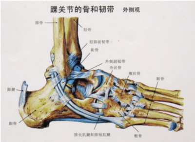 踝关节扭伤以外侧多见,这是由踝关节的结构及功能决定的,从骨性结构