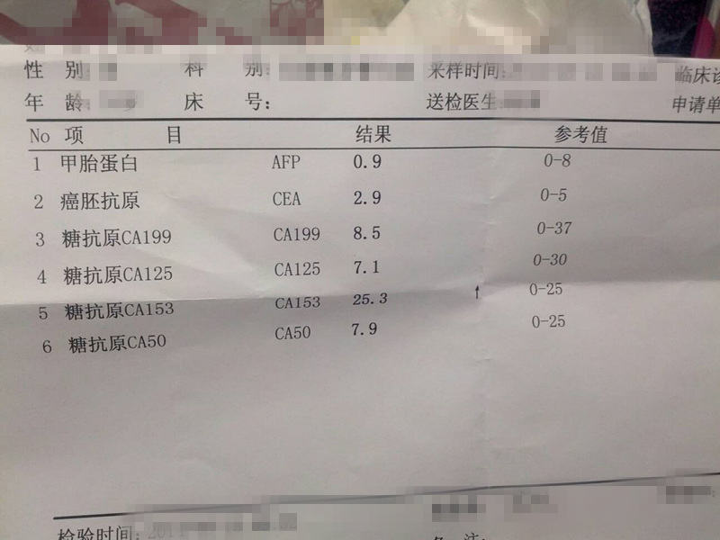 此外还有tpa,psa,对膀胱癌及前列腺癌的敏感性较高.