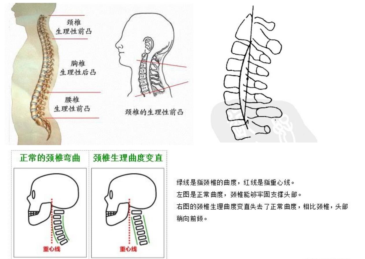 图18-318 颈椎侧面观(1)-口腔颌面及颈部临床解剖学-医学
