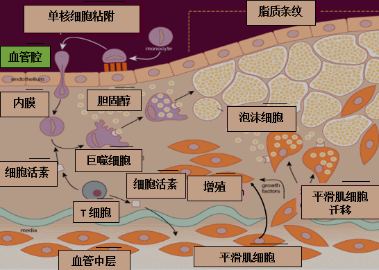 冠状动脉及"冠状动脉粥样硬化"