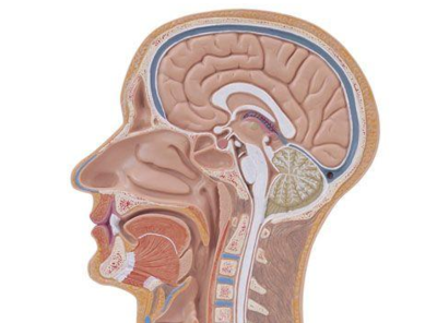 小脑扁桃体下疝畸形的分型介绍——Ⅲ型