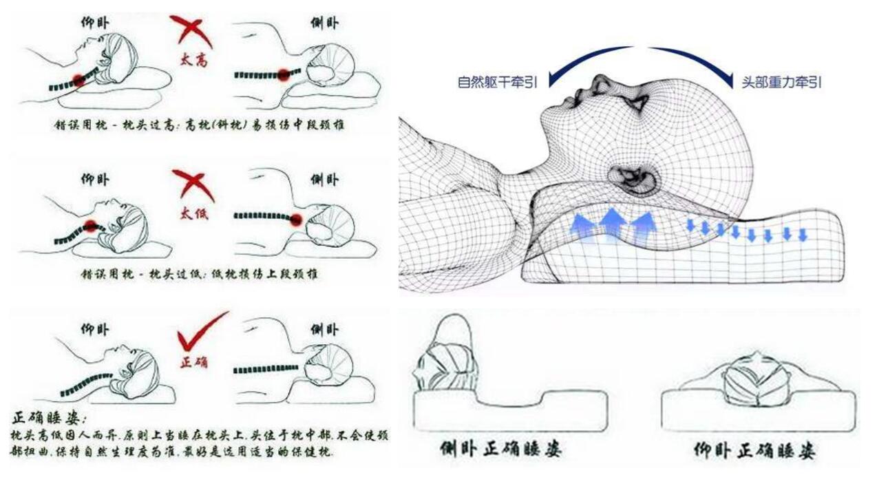 正确的睡姿减少"落枕"发生