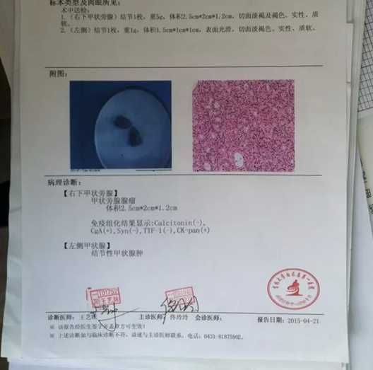 甲状腺手术后复查需要注意事项