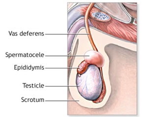 二,附睾囊肿有啥危害吗: 附睾囊肿多发于20-50岁男性.