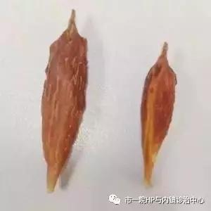 致命的枣核