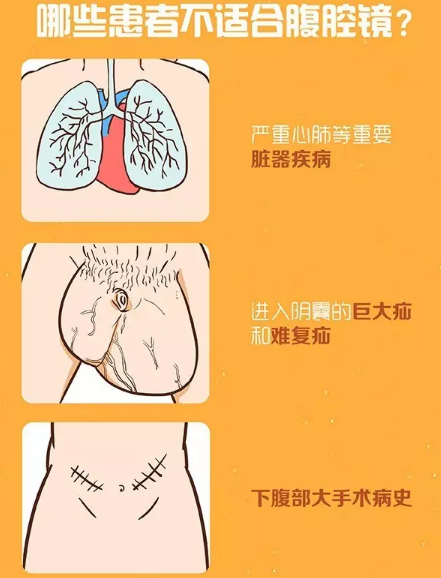 好男怕缠疝啊被小肠气缠上怎么办