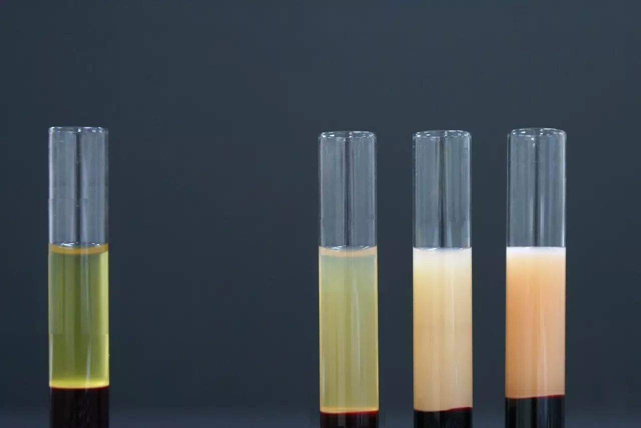 高脂血症是隐形的杀手如果你的血浆中胆固醇和/或甘油三酯水平过高