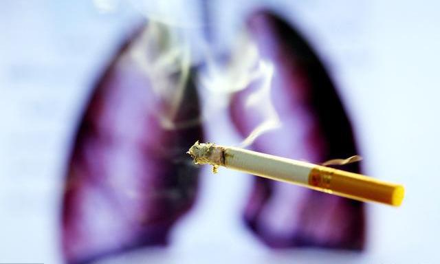 肺癌死亡人口_死亡证明肺癌
