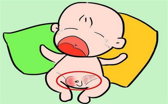 宝宝精索鞘膜积液图片图片