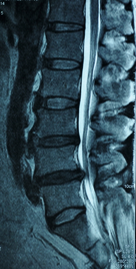 7PI12484903.jpg?token=69e53c5ef31b8bd812eaff40febd57c9