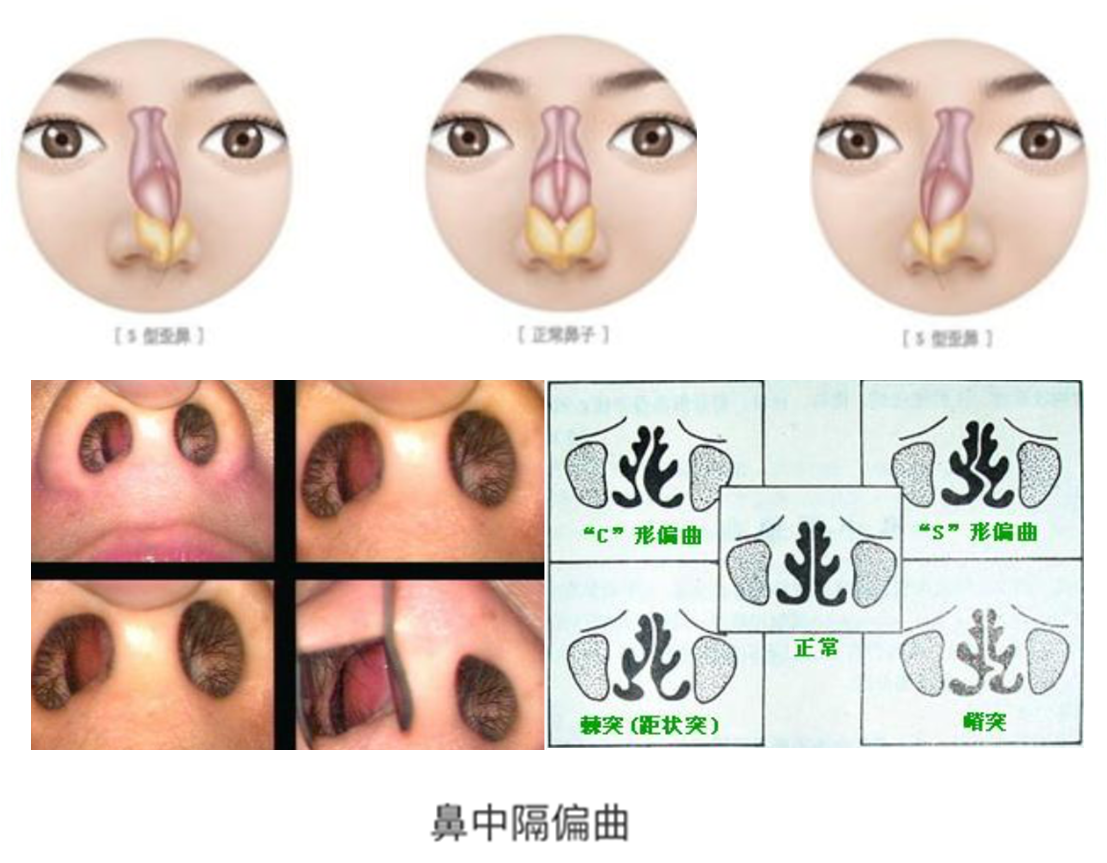 口呼吸不是唯一的呼吸方式