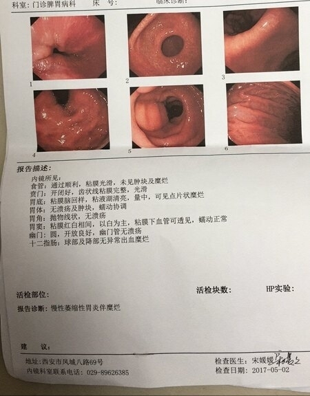 没做病理能诊断萎缩性胃炎吗?