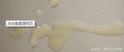 少年或者夫妻两地分隔长期禁欲者,由于理化性质改变,精液颜色会发黄些