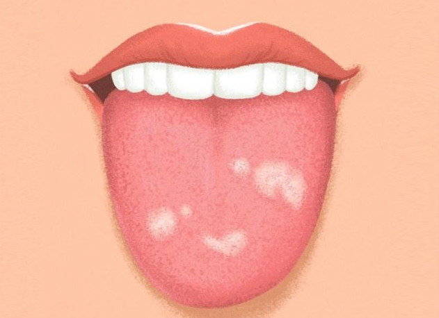 你的舌头可以告诉你关于健康的9件事情