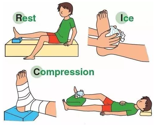 崴脚可不简单-踝关节扭伤的正确处理
