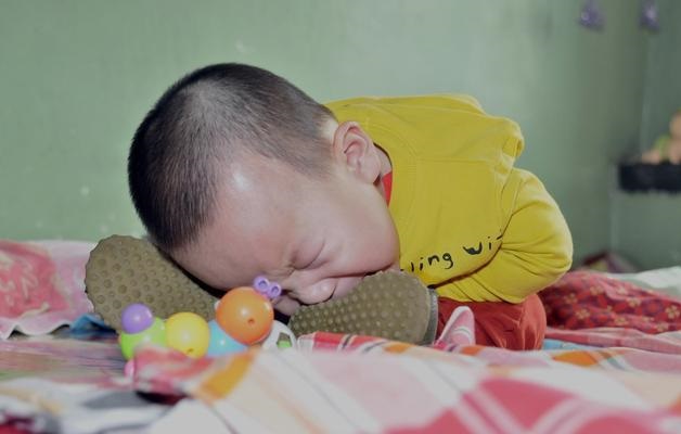 颈向后伸,下肢伸或交叉,双手拿不到前中位,呈角弓反张性躯干伸展