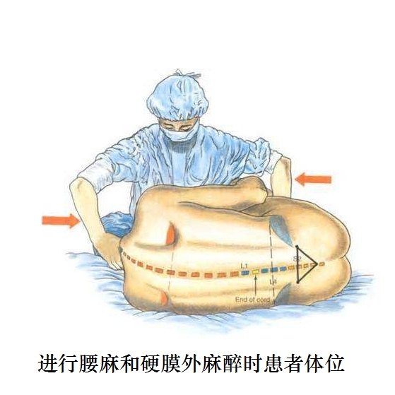 肾结石,输尿管结石微创治疗麻醉必读