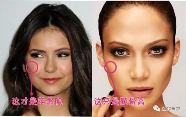 童颜必备的苹果肌你有吗?