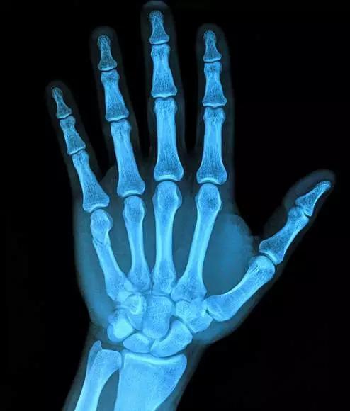 7招锻炼法,告别手部关节炎