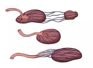 前置血管:脐带帆状附着时,如果,胎膜上血管跨过宫颈内口,恰好同时