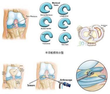 二沙岛医院骨科---关节外科专业组简介