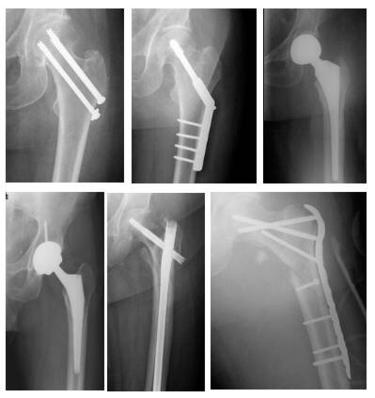 二沙岛医院骨科---关节外科专业组简介