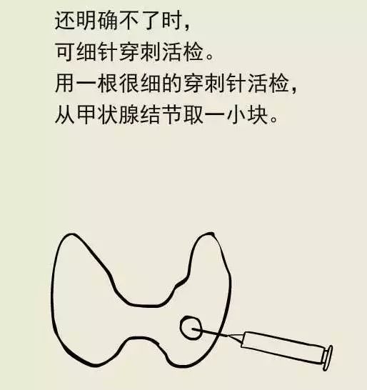 甲状腺那些事