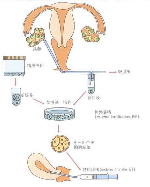 试管婴儿的流程