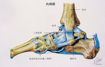 膝外翻胫骨内踝间距图图片