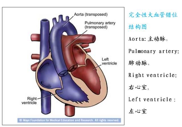 左右肺动脉交叉图片