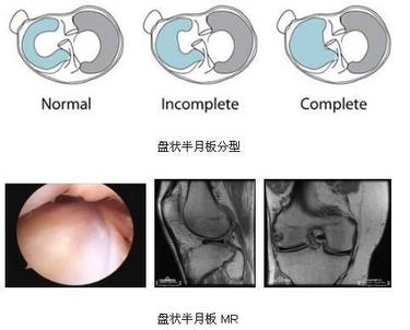 二沙岛医院骨科---关节外科专业组简介