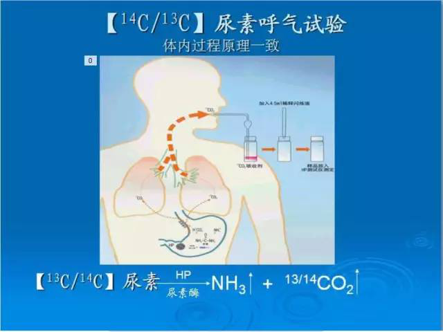 自测试剂盒多少钱一个_试剂盒检测准确率高吗_试剂盒检测方法