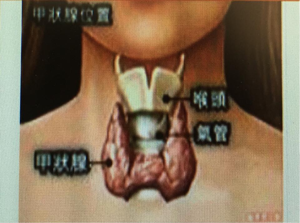 甲状腺分布图片