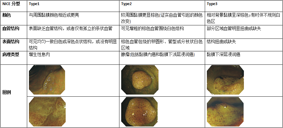 早期食管鳞癌及结直肠癌的内镜诊断标准介绍 微医(挂号网)