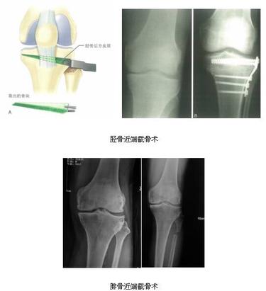 二沙岛医院骨科---关节外科专业组简介
