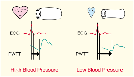高血压(之二)高血压吃药有讲究,什么时间吃药最好?
